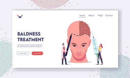 Hair Loss and Receding Landing Page Template. Tiny Doctor Characters Prepare Huge Male Head for Hair Transplantationのイラスト素材