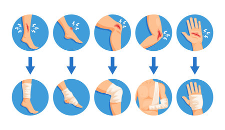 Hand And Leg Bandaging Process, Wrapping Bandages Around An Injured Area. Infographics For Healthcareのイラスト素材