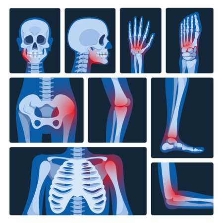 X-ray Pictures Vector Set. Medical Images Revealing Internal Structures Of The Body. They Help Diagnose Conditionsのイラスト素材