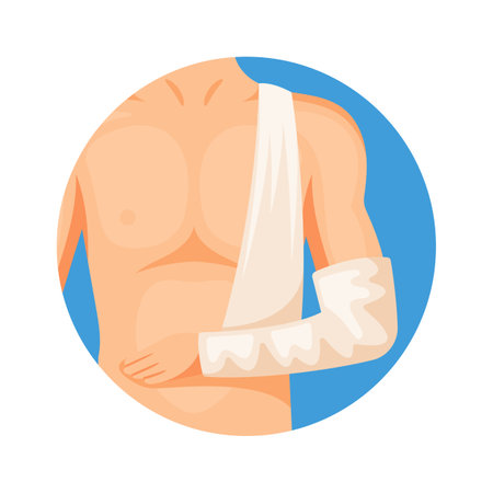 Broken arm in gypsum vector illustrationのイラスト素材