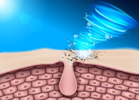 Clean the skin Remove dirt and ingrained Keep the skin deeply clean Without dirt clogging The cause of acne and dermatitis. Vector Realistic file.のイラスト素材