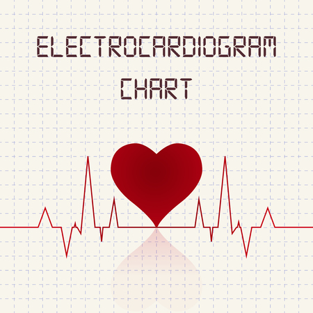 Electrocardiogram (ECG) chart table - healthcare infographicのイラスト素材