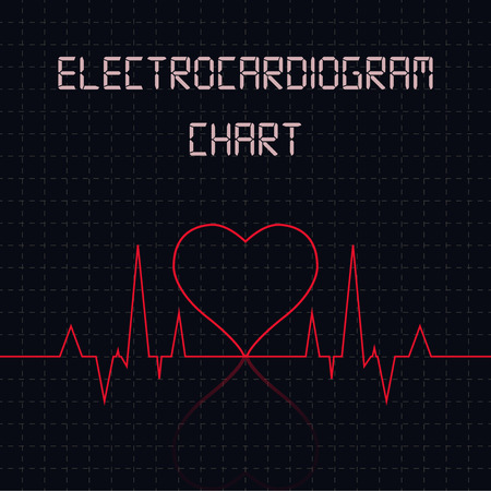Electrocardiogram (ECG) chart table - healthcare infographicのイラスト素材