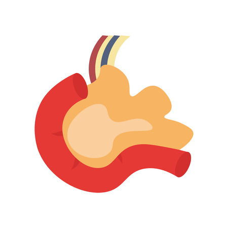 Caries icon vector isolated on white background for your web and mobile app design, Caries logo conceptのイラスト素材