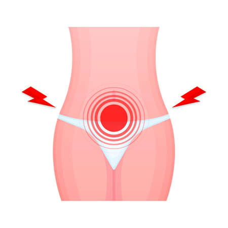 Abdominal pain, Diarrhea or constipation. Menstruation Symptom. Vector illustration.のイラスト素材
