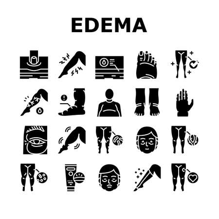 Edema Disease Symptom Collection Icons Set Vector. Venous And Fatty, Lymphatic And Hypoproteinemic, Allergic And Heart Edema Health Problem Glyph Pictograms Black Illustrationsのイラスト素材