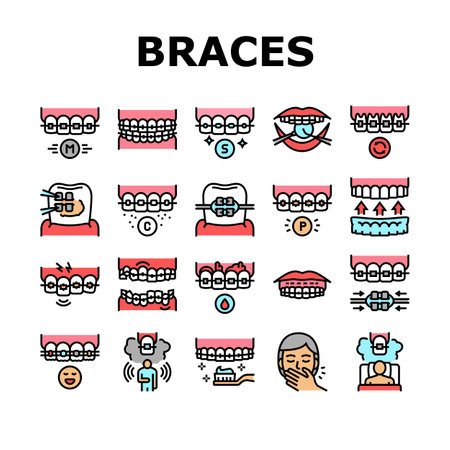 Tooth Braces Accessory Collection Icons Set Vector. Tooth Braces Installation And Correction, Metal And Sapphire, Ceramic And Plastic Material Concept Linear Pictograms. Contour Color Illustrationsのイラスト素材