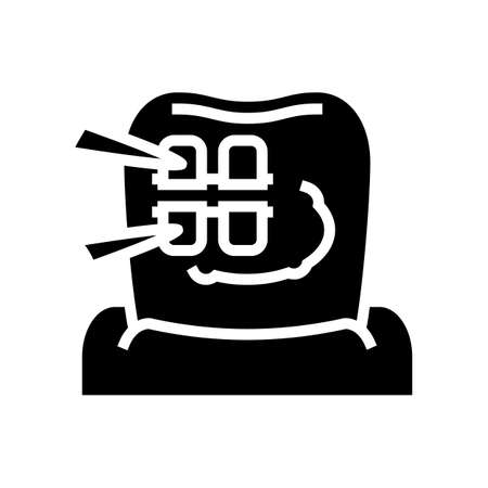 installation tooth braces glyph icon vector. installation tooth braces sign. isolated contour symbol black illustrationのイラスト素材