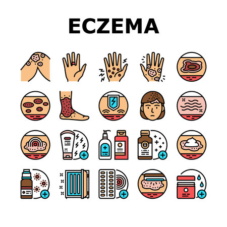 Eczema Disease Treat Collection Icons Set Vector. Nummular And Neurodermatitis Eczema Treatment, Dry Skin And Pain, Contact And Atopic Dermatitis. Concept Linear Pictograms. Contour Illustrationsのイラスト素材