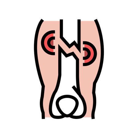closed limb fracture disease color icon vector. closed limb fracture disease sign. isolated symbol illustrationのイラスト素材