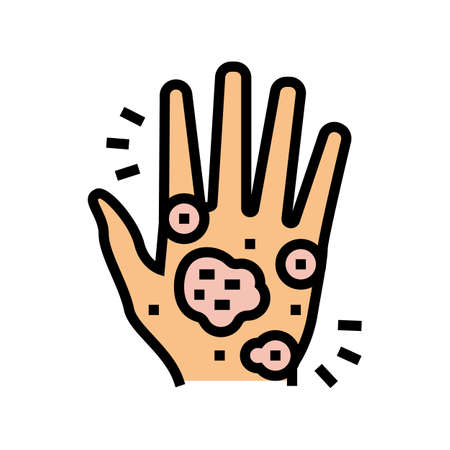 hand eczema color icon vector. hand eczema sign. isolated symbol illustrationのイラスト素材