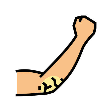 elbow dry skin color icon vector. elbow dry skin sign. isolated symbol illustrationのイラスト素材