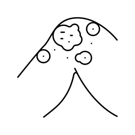 atopic dermatitis line icon vector illustrationのイラスト素材