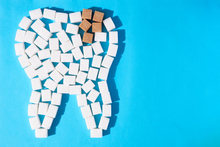 brown caries sugar on white tooth on blue background closeup. High quality photo