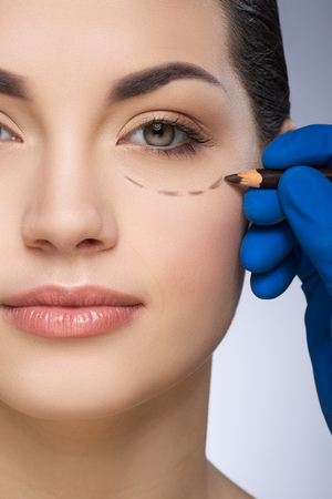Plastic surgeon drawing dashed line under eyeの写真素材