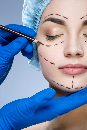 Perforation lines on patients faceの写真素材