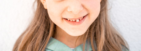 Charming smiling little girl kid with opened mouth shows staggering loose falling out first baby milk front tooth. Preschooler teeth changing. Healthy dental hygiene. lost tooth. Dentist treatment.の写真素材