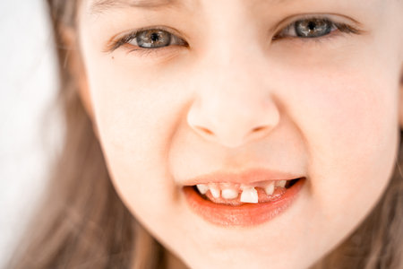Charming smiling little girl kid with opened mouth shows staggering loose falling out first baby milk front tooth. Preschooler teeth changing. Healthy dental hygiene. lost tooth. Dentist treatment.の写真素材