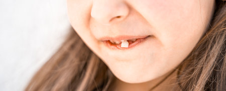 Charming smiling little girl kid with opened mouth shows staggering loose falling out first baby milk front tooth. Preschooler teeth changing. Healthy dental hygiene. lost tooth. Dentist treatment.の写真素材