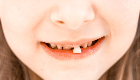 Charming smiling little girl kid with opened mouth shows staggering loose falling out first baby milk front tooth. Preschooler teeth changing. Healthy dental hygiene. lost tooth. Dentist treatment.の写真素材