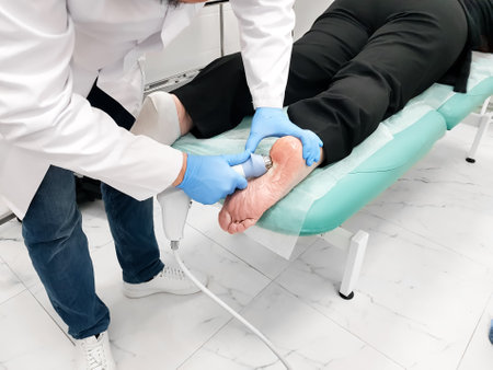 Extracorporeal shock wave therapy ESWT of heel. Visit to office of orthopedic surgeon doctor. Effective non-surgical treatment, pain relief. Physical therapy for plantarf ascitis with shock waves.の写真素材