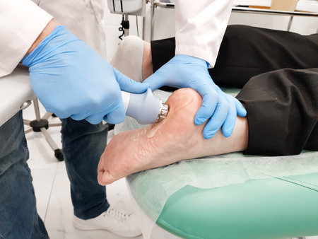 Extracorporeal shock wave therapy ESWT of heel. Visit to office of orthopedic surgeon doctor. Effective non-surgical treatment, pain relief. Physical therapy for plantarf ascitis with shock waves.の写真素材