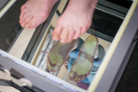 Step Digital Foot Scan, Orthotics Foot Scan for Custom Made Shoe Insoles, Posture and equilibrium analysis. Doctor, patient. Posture and equilibrium analysis. Growth, balance.の写真素材