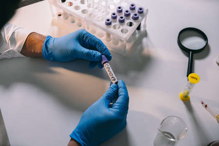 Physician hold laboratory test tube with blood marked and labeled virus. Positive blood sample in doctors hand with gloves. Analyzing in reseach laboratory.の写真素材