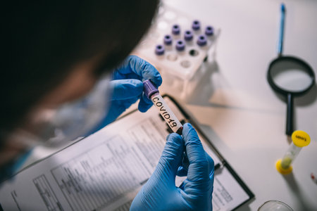 Doctor holding test tube with blood for 2019-nCoV analyzing. Coronavirus disease COVID-19 pandemic. Healthcare medicine concept, virus test. Checking the population for immunity to covid 19.の写真素材