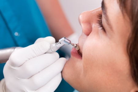 Special care dental braces manの写真素材