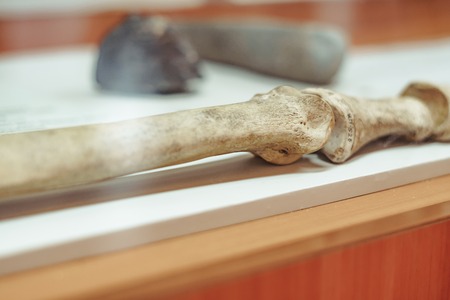 Skull and bones dug from a pit in a terrible cemetery with a dim light