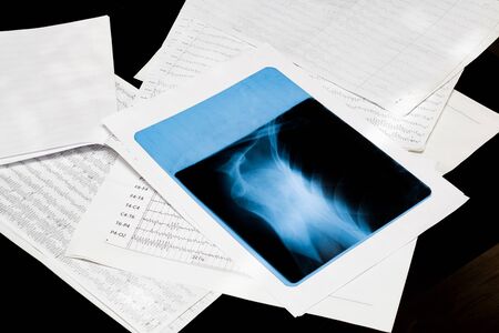 X-rays of the shoulder on white papers close up