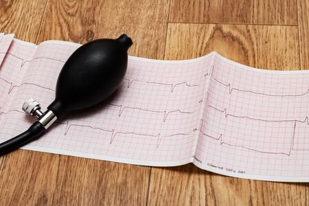 Black pear tonometer on the results of a cardiogramの写真素材