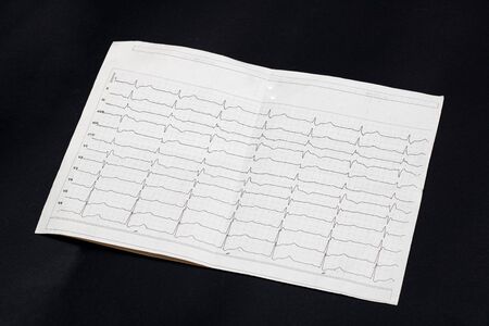 Cardiogram results on a black background close upの写真素材