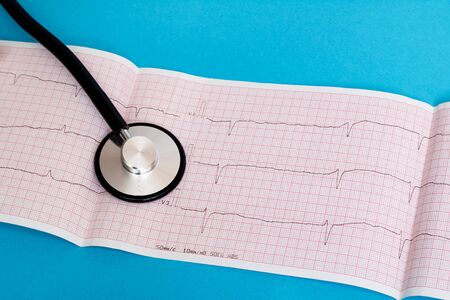 Stethoscope and cardiogram results on a blue background close up