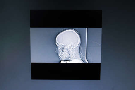 Image of computed tomography of the brain close upの写真素材