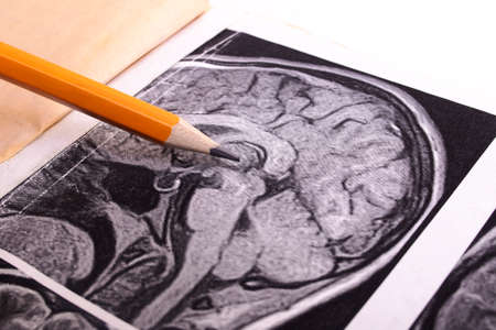 MRI image of the brain on paper close upの写真素材