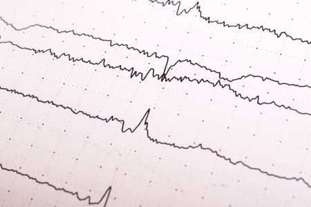 Electroencephalogram graph on a white paper close upの写真素材