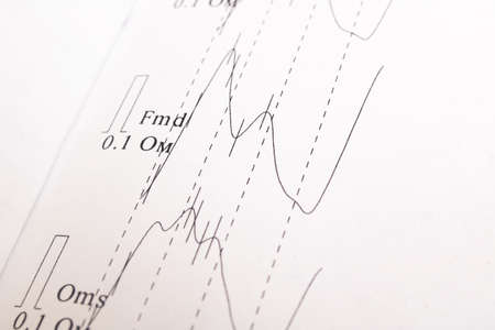 Research schedule Rheoencephalography on a white paper close upの写真素材