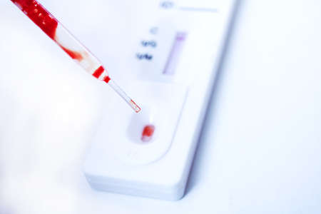 Pipette with blood and test for antibodies to virus close upの写真素材