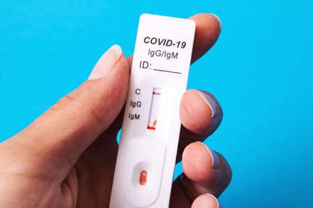 Rapid test for antibodies to coronavirus close upの写真素材