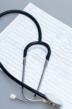 Ambulance, EEG graph and stethoscope on gray background close up
