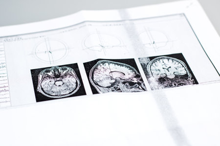 Image of the brain on the results of the study close upの写真素材