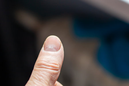 This is a detailed closeup image featuring a persons thumb, with a soft, blurred background enhancing the focus on the thumb itselfの写真素材