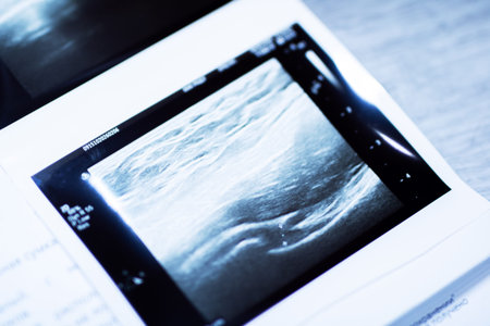 Diagnostic ultrasound image on clinic desk, highcontrast grayscale printout angled over patient...