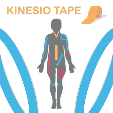 Therapy with kinesio tape. Body and an example blend. Vector illustration.のイラスト素材