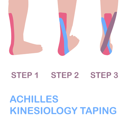Achilles kinesiology taping. Vector illustration.のイラスト素材