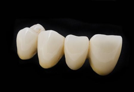 ceramic tooth in dental laboratory