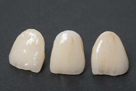 ceramic crowns in dental laboratoryの写真素材