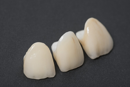 ceramic crowns in dental laboratory